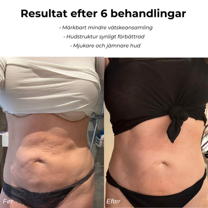 Celluboost - Säg adjö till celluliter