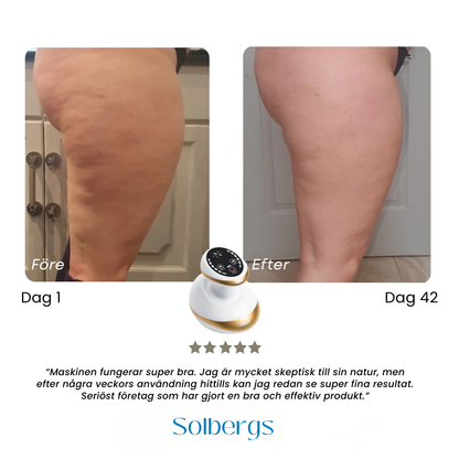 Celluboost - Säg adjö till celluliter
